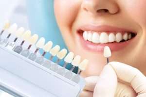 dentist with shade guide